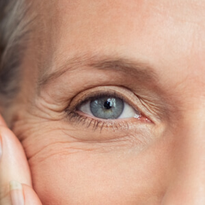 Blépharoplastie