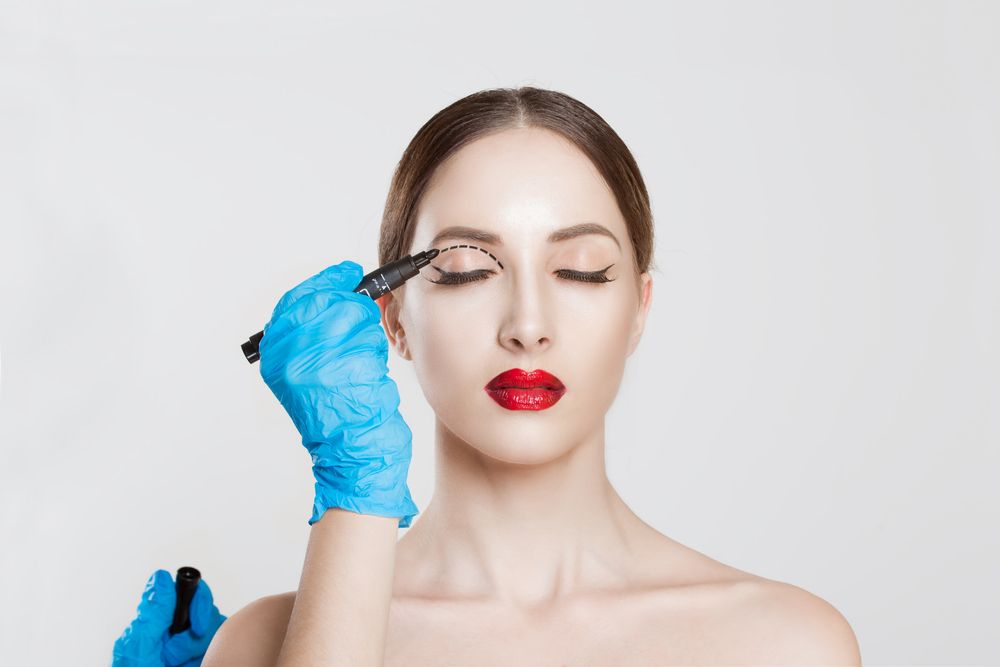 blépharoplastie