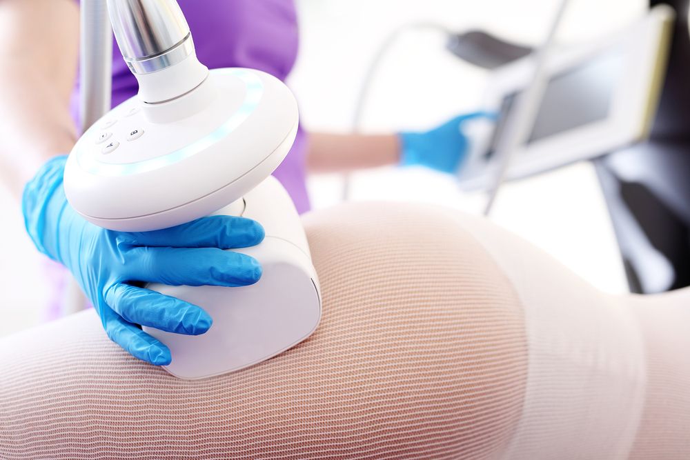 Liposuccion : attentes et réalité