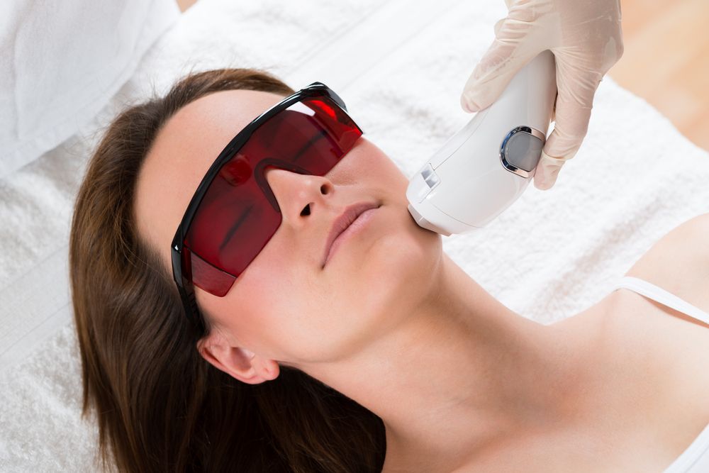 laser pour le visage
