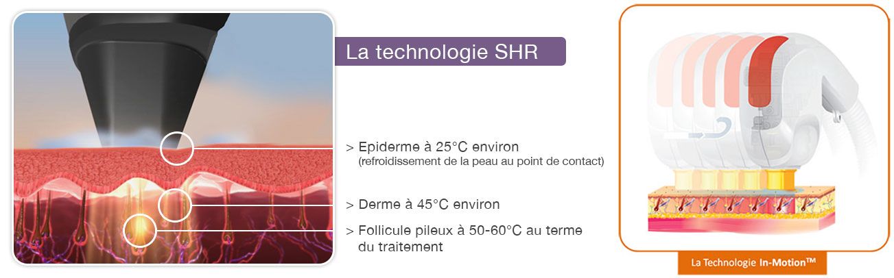 technologie SHR In-Motion®