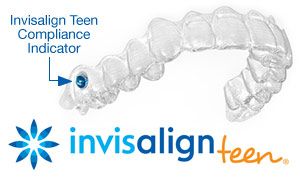 Invisalign