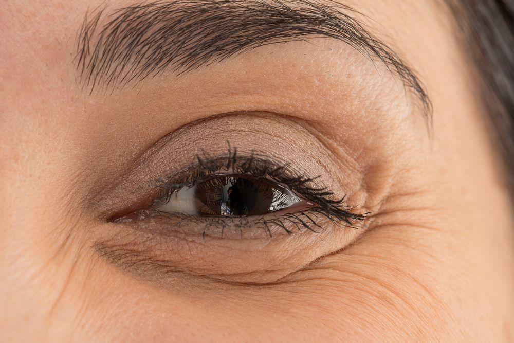 Qu'est ce que la blépharoplastie laser ?