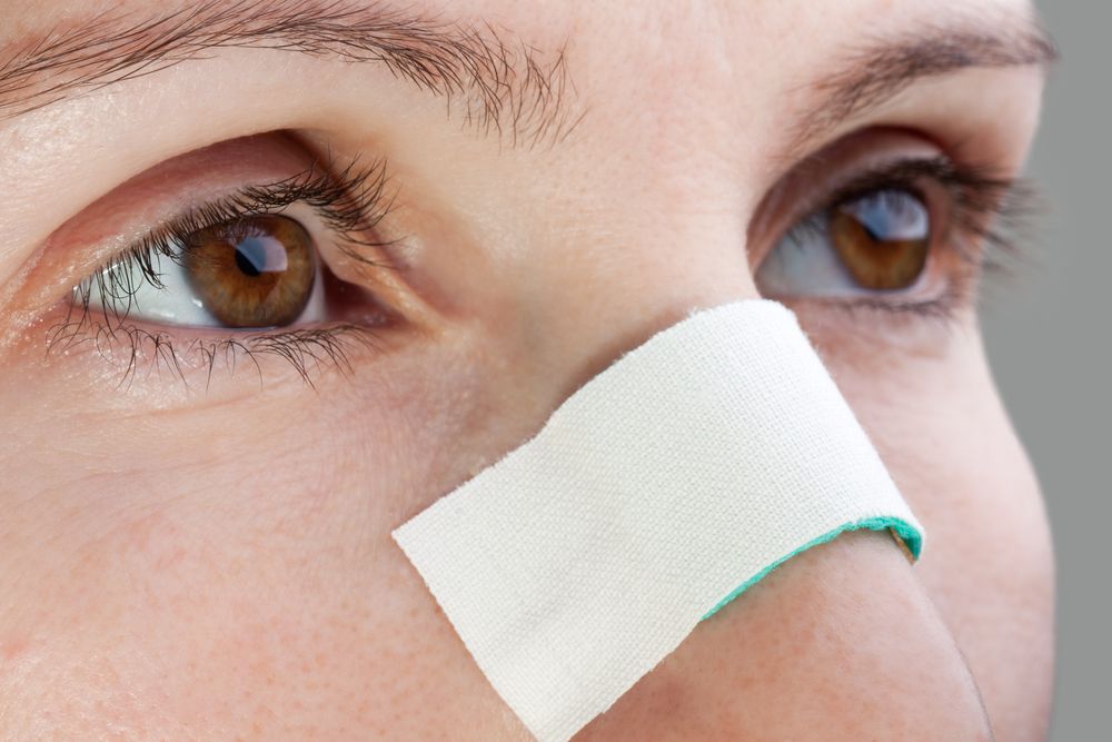 rhinoplastie mauvais résultats esthético-fonctionnels