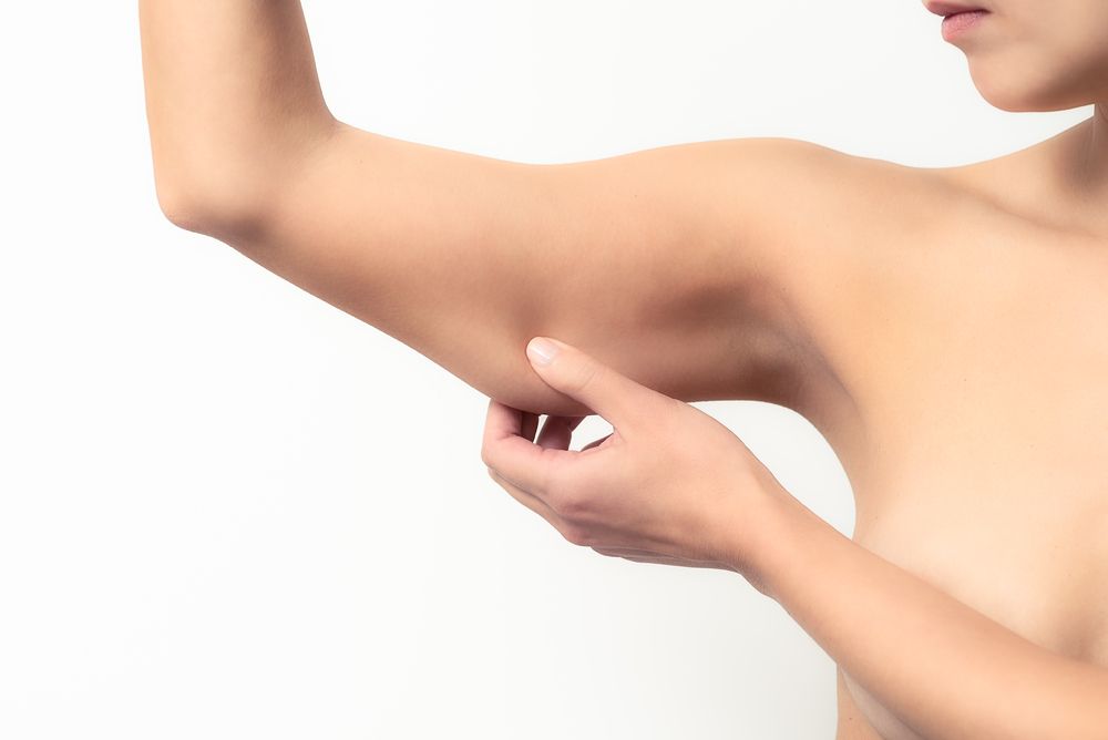 Liposuccion vers brachioplastie
