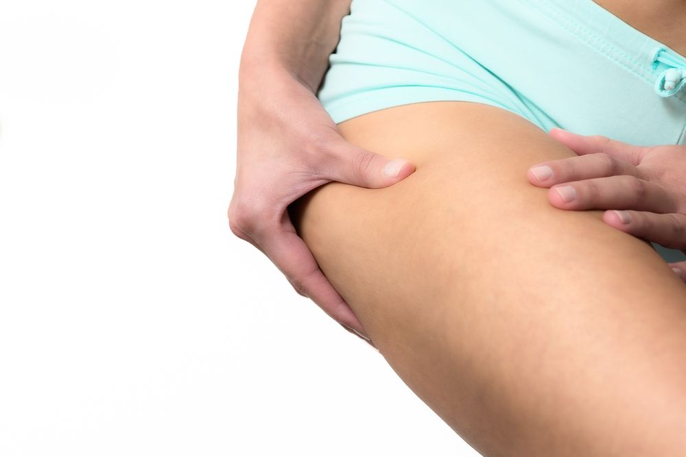 la liposuccion tumescente