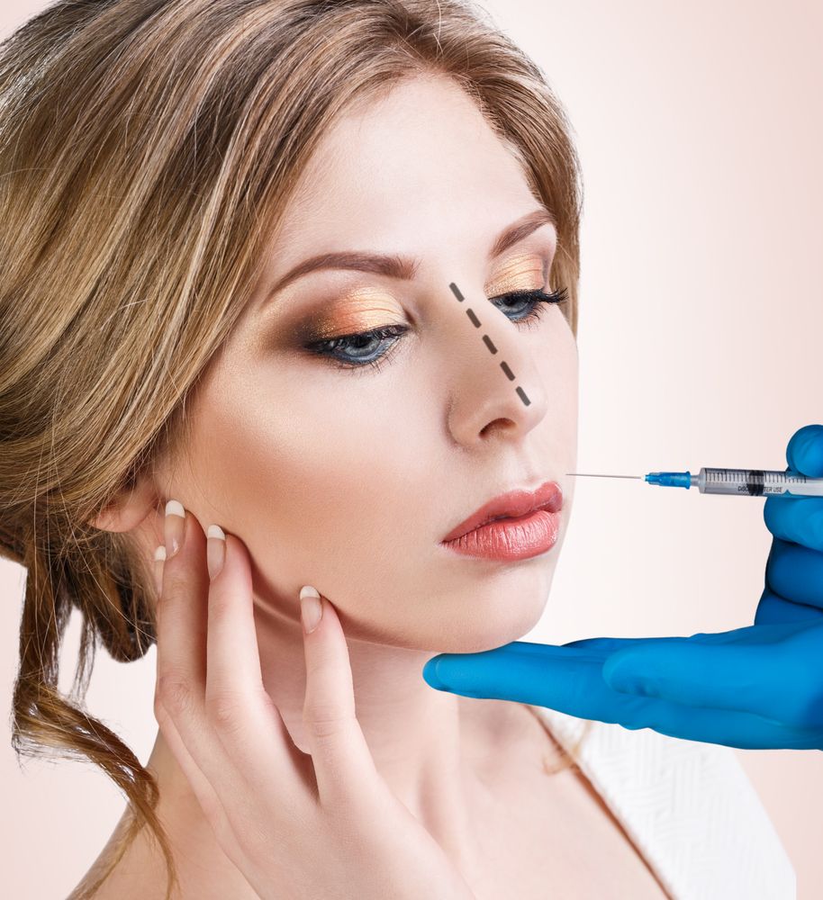 rhinoplastie