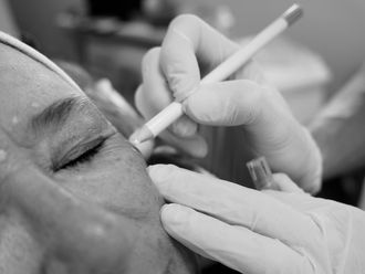 Botox - 622870